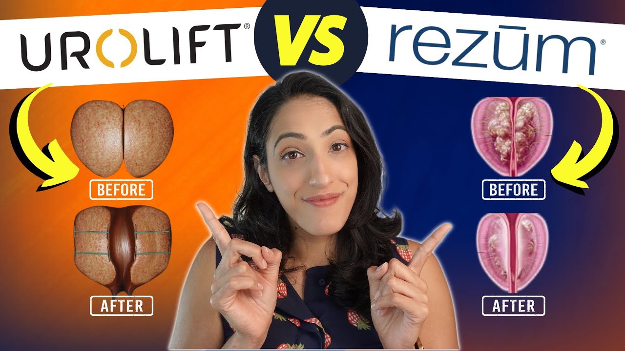 Enlarged Prostate Treatments That Won’t Impact Your Sex Life? | Rezum vs Urolift