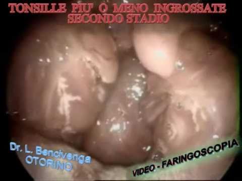 Dikulja tecnica nel trattamento delle articolazioni Langetka sul polso con fissaggio
