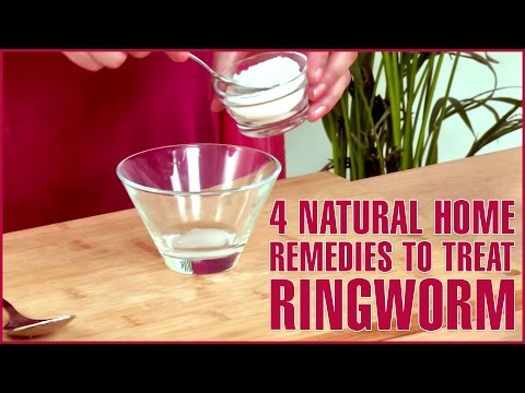 4 Best Natural Home Remedies For RINGWORM TREATMENTS