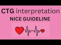 CTG interpretation NICE guideline   |aqorn learning | @rahat2021| obgyn | FCPS |