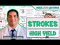 Ischemic And Hemorrhagic Strokes High Yield