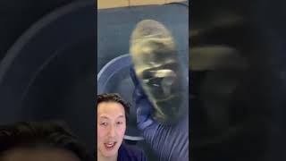 Download lagu Today I Removed 15 Year Old Saline Breast Implants! #shorts #breastimplants mp3