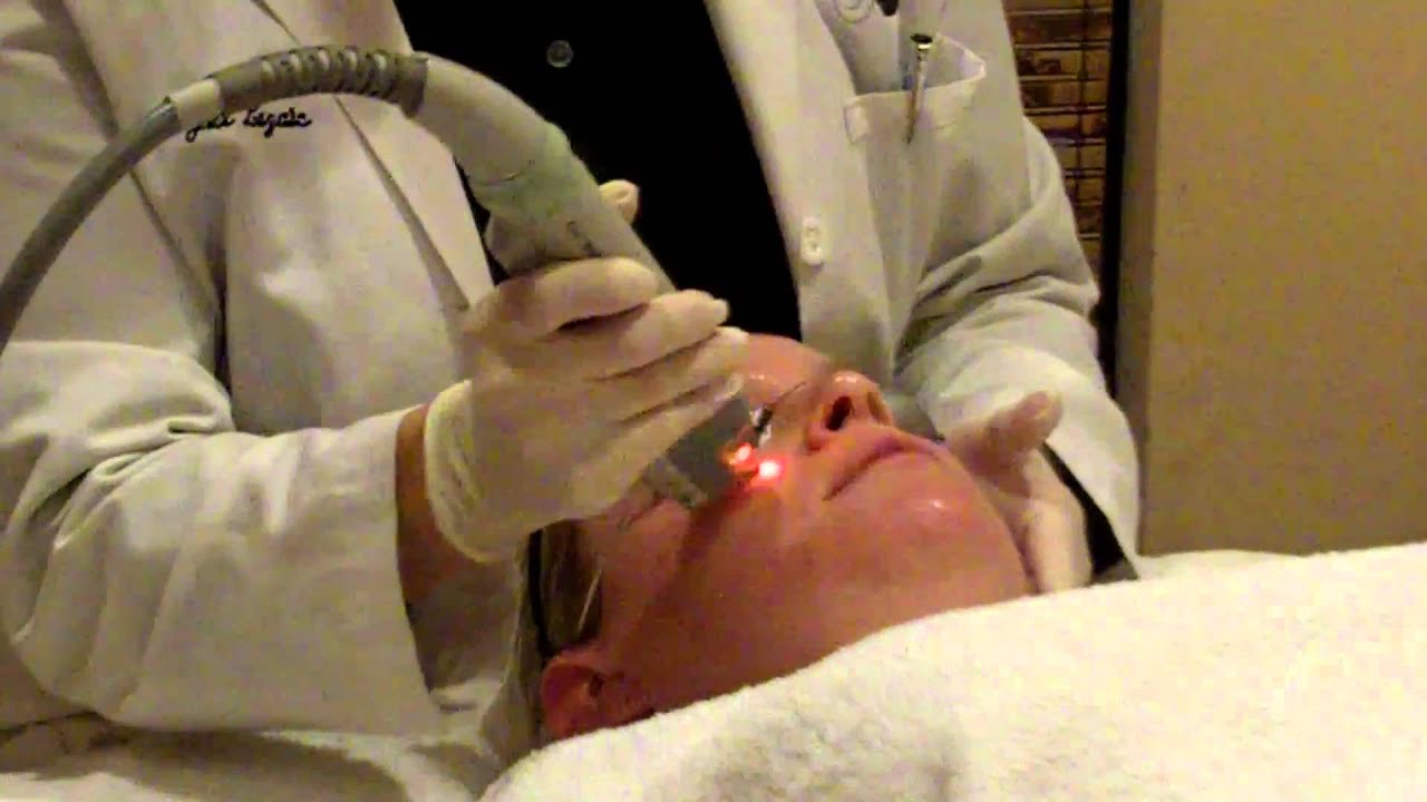 Laser Genesis by Dr.Jill Lezaic