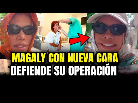 Magaly Medina defends her face surgery! 15 years younger!