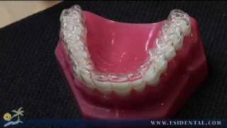 Long Island  Ivisalign® Invisible Braces  ESI Dental
