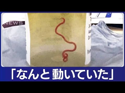 衝撃的:水道水で脳を蝕む寄生虫が発見される