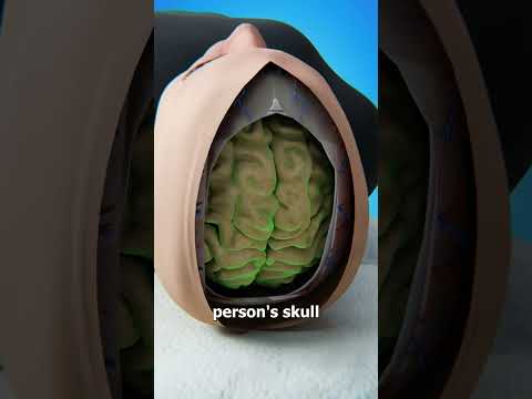 is it possible to swap  the brain without harming the nerves?