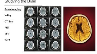 Introduction to Psychology: 2.2 - Brain Plasticity and Neuroimaging