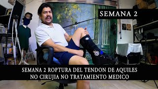 Usando la bota Walker Semana 2 Roptura del Tendon de Aquiles No Cirugia No Tratamiento Medico