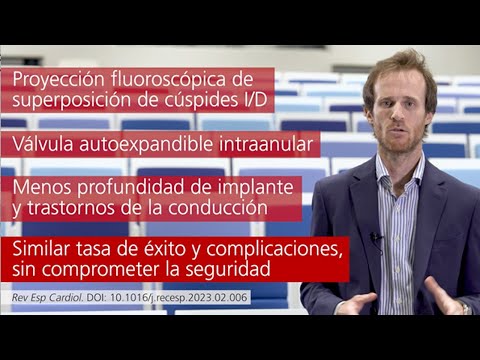 Técnica de superposición de cúspides en TAVI con el sistema Portico FlexNav