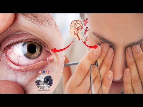 Po u dëmton rëndë shikimin pa e kuptuar, ja cilat janë shenjat e para te verberise qe nuk duhet ti