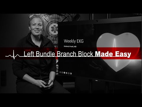 Left Bundle Branch Block Made Easy