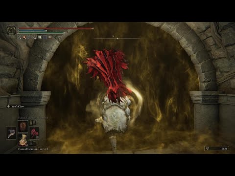 "Elden Ring needs Easy Mode"