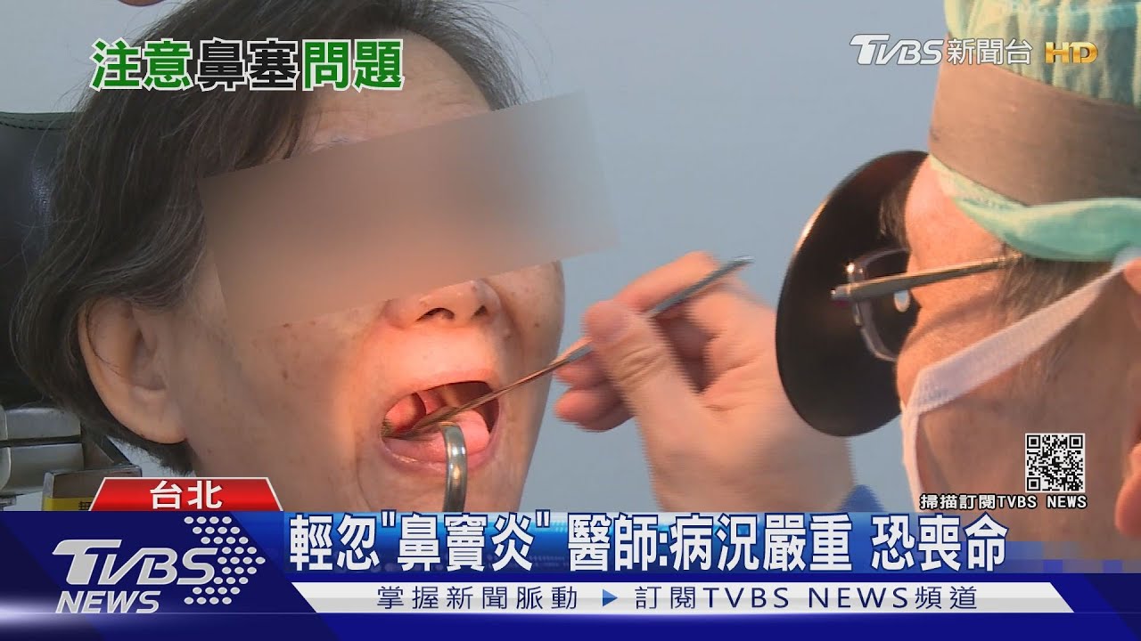 長時間鼻塞、黃鼻涕 醫師:若拖延病情恐喪命!