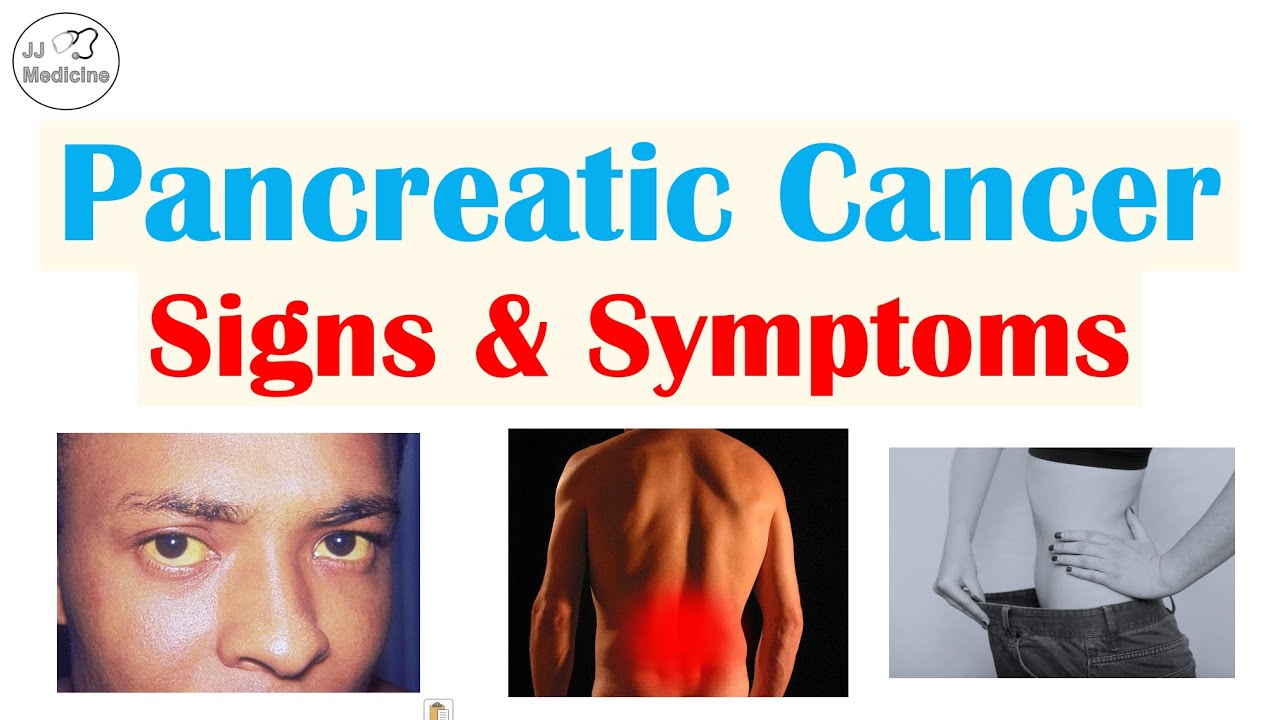 Pancreatic Cancer Signs & Symptoms (& Why They Occur)