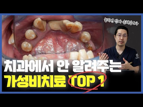 치과의 가성비치료, 잇몸치료란?