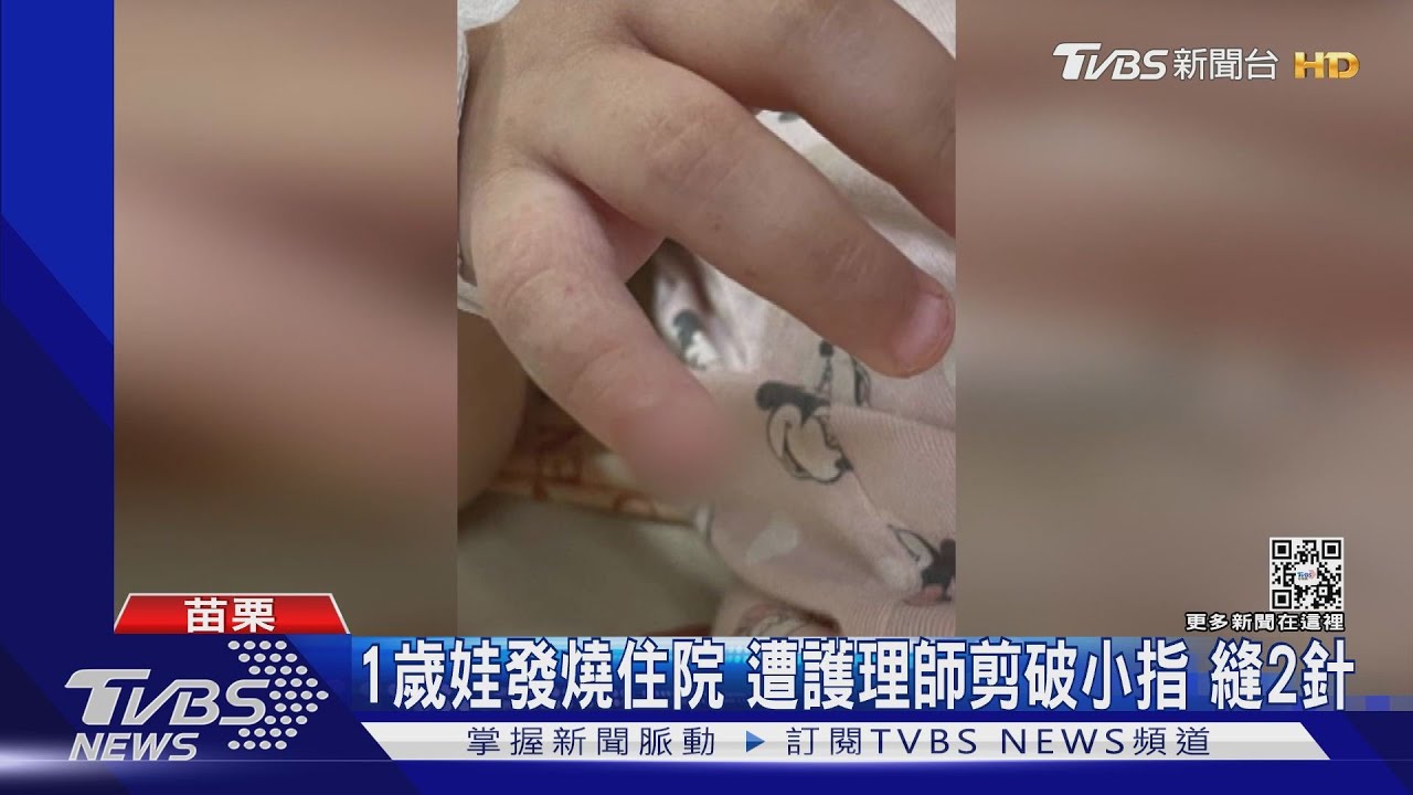 剪破娃手指! 護理師拆膠帶剪到童小指肉縫2針家屬怨