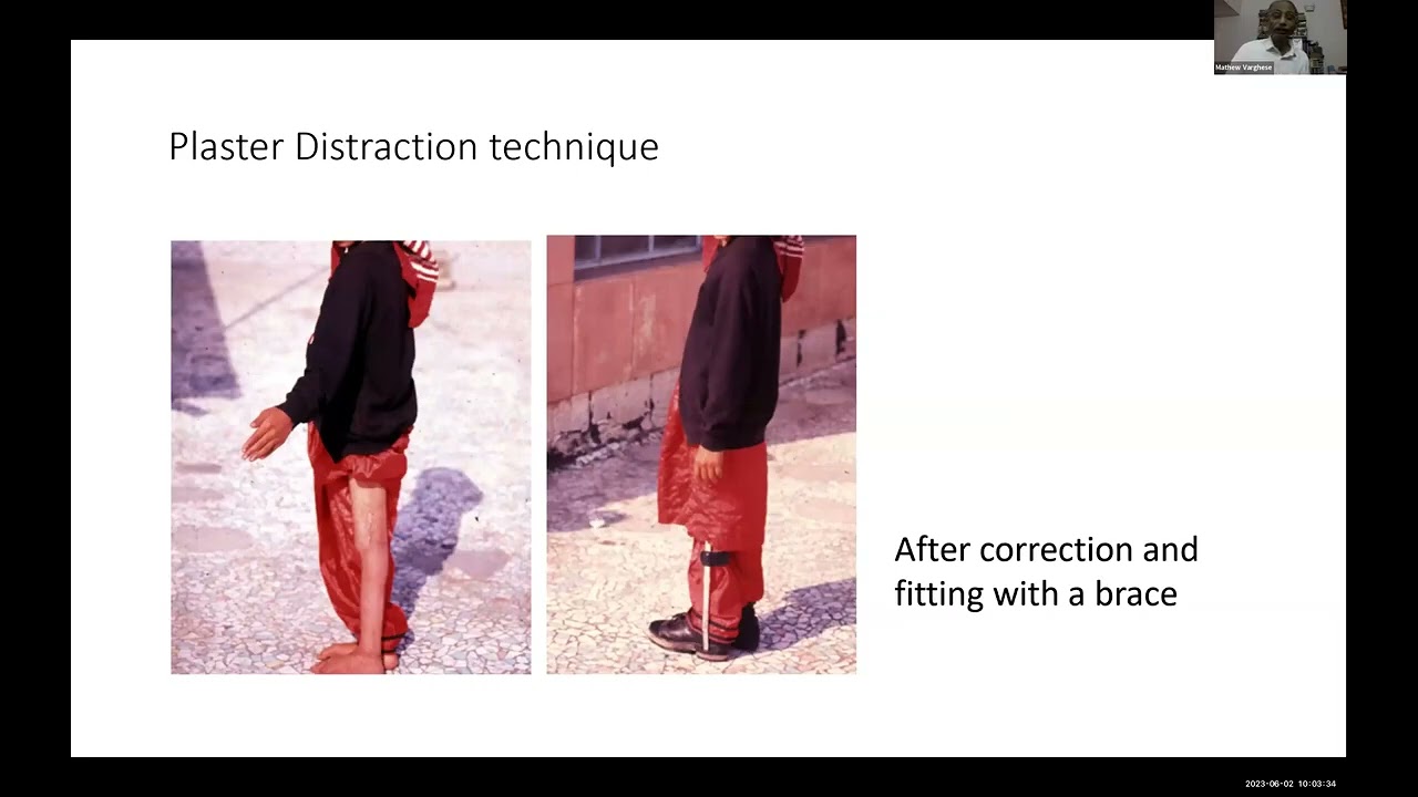 Session 10: Lessons Learned From Across the Globe India