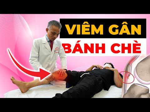 Đầu Gối Sưng Đau Không Thể Đi Lại? Điều Trị Viêm Gân Bánh Chè Hiệu Quả 99%