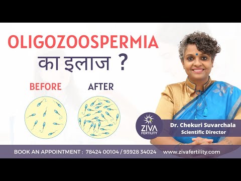 Oligozoospermia || Treatment Options For Low Sperm Count || Dr Chekuri Suvarchala || Ziva Fertility