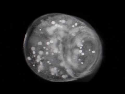 Dopplereffekt - Gene silencing [Official video]