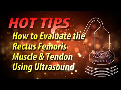 How to Evaluate the Rectus Femoris Muscle and Tendon Using Ultrasound