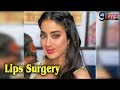 Reality Behind Jhanvi Lips Surgery Janhvi Kapoor Lips Surgery Secret Next9Life