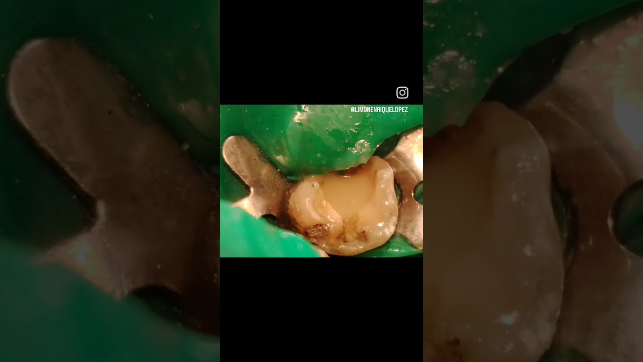 Enrique López Limón-44