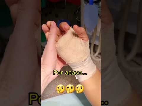 Quanto tempo para se recuperar de uma cirurgia de túnel do carpo?