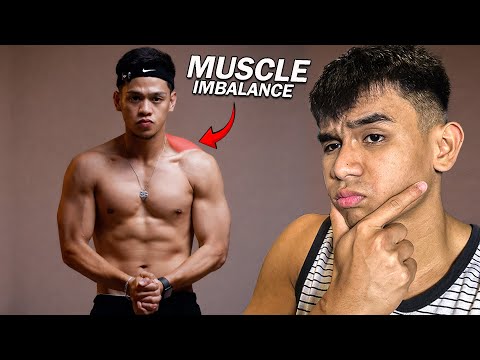 Bakit hindi Pantay ang KATAWAN ni VON?