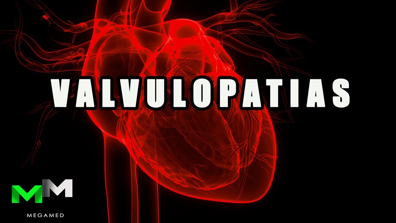 Valvulopatias