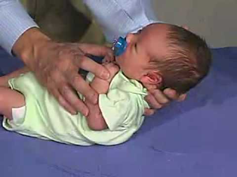 physical exam -Newborn Normal: Primitive Reflexes - Moro