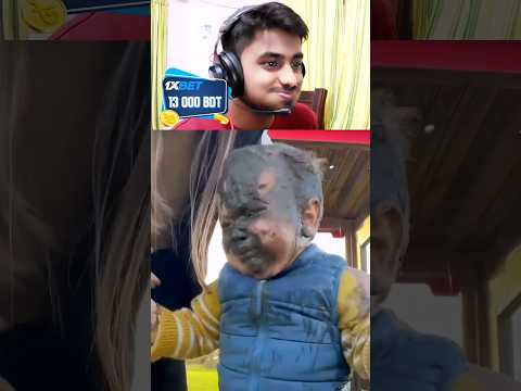 If You Laugh , You Lose 😂 (part5) #shorts