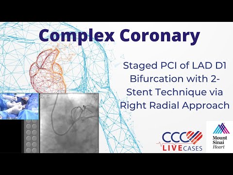 Staged PCI of LAD D1 Bifurcation w 2-Stent Technique via Right Radial Approach -Dec 15, 2015 Webcast