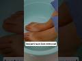 Slipper Marks Removal In 10 Mins Shorts Viral Tanning Youtube