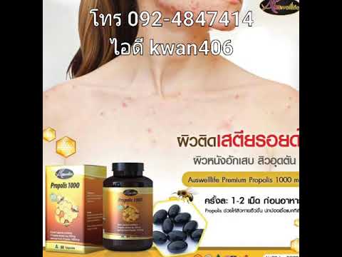 ครีมสำหรับชื่อเรื่องโรคสะเก็ดเงิน โรคสะเก็ดเงินหญ้า 60