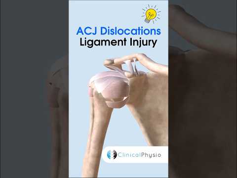 ACJ Dislocations: Which Ligaments Are Injured? #physicaltherapy #physiotherapy