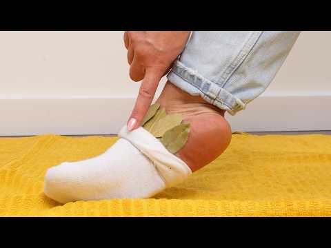 Put bay leaves in your socks. See how it works.