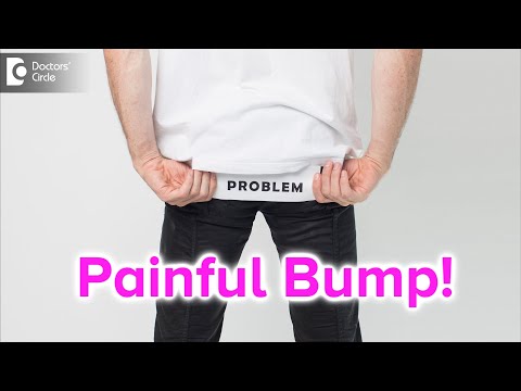 Painful bump on buttocks. Causes, Symptoms, & Treatment - Dr. Rajdeep Mysore | Doctors' Circle