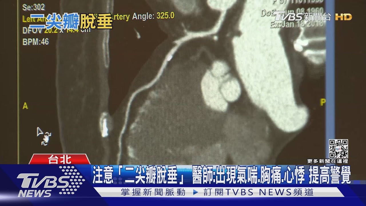 「二尖瓣脫垂」發生關鍵在於這兩大因素 醫:輕忽恐致命!