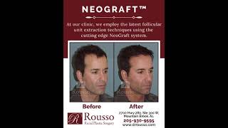 Rousso Adams Facial Plastic Surgery