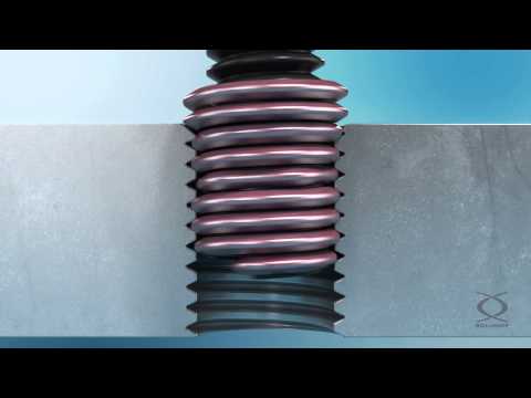 Helicoil Screwlock - Assembling and function