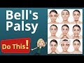 SELF CARE FOR BELL S PALSY
