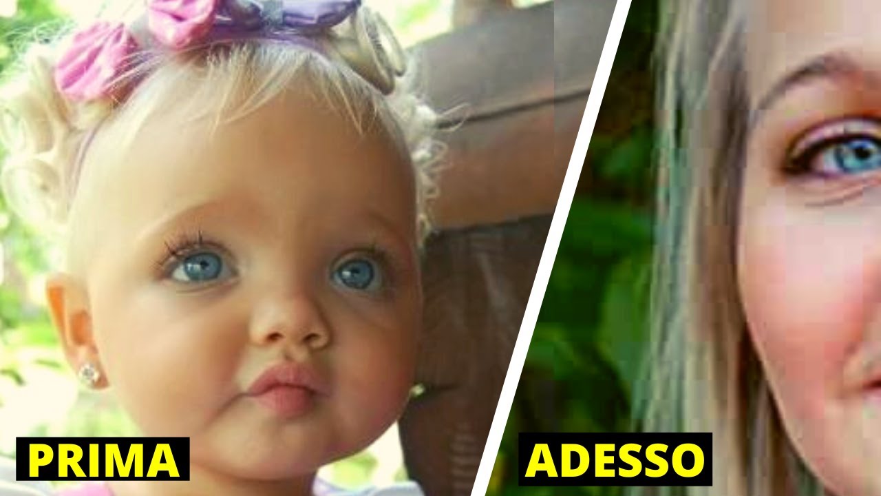 Ricordate “la Bambina più Bella del Mondo” Ecco che Aspetto Ha Oggi