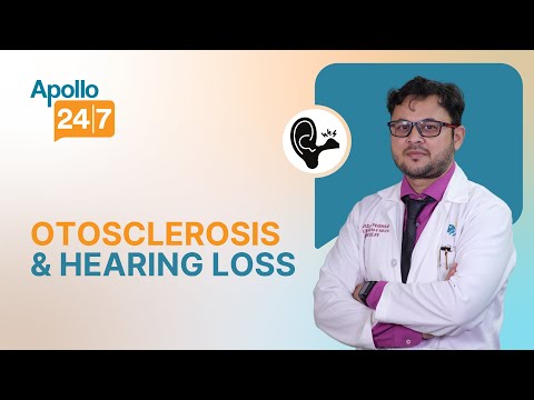 How to Get Rid of Warts Masse Dr Srabani Ghosh Zoha