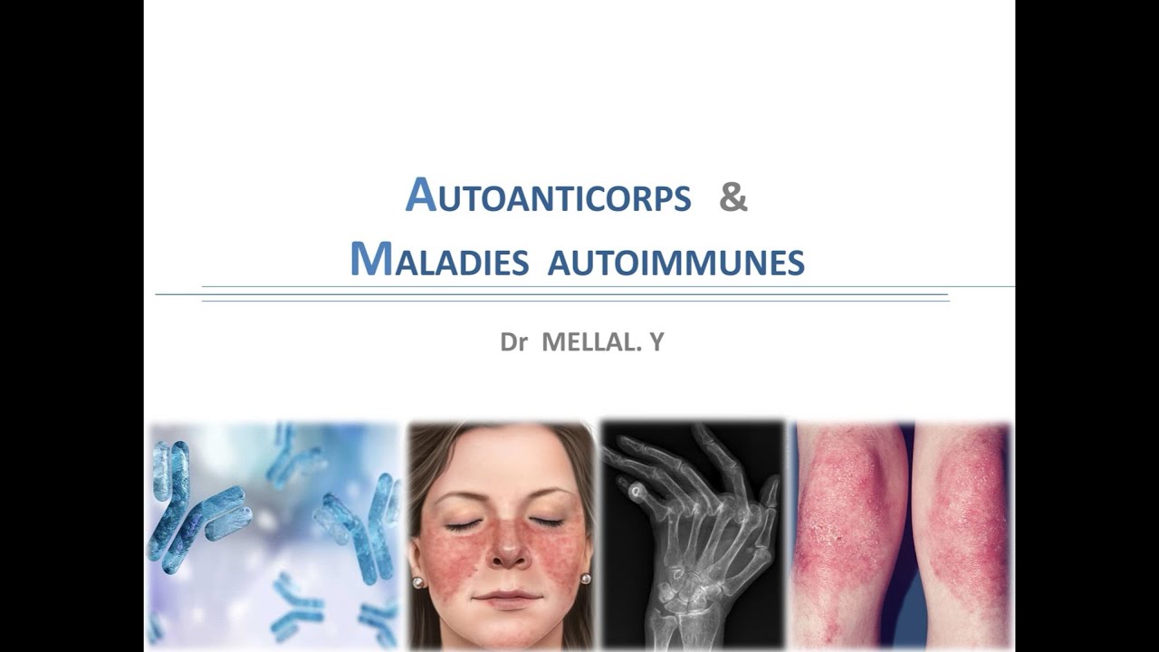 Maladies auto-immunes (MAI) partie 2