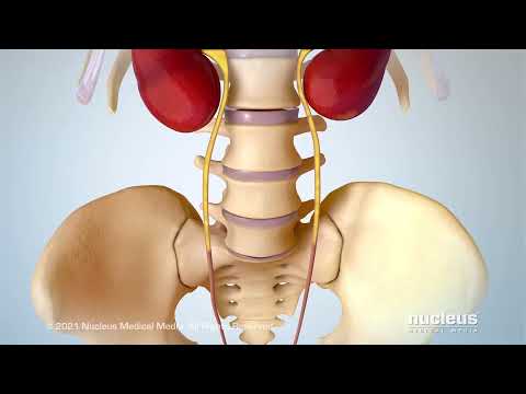 Stress Urinary Incontinence (SUI)