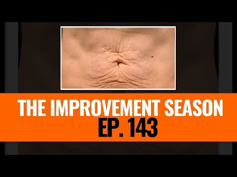 143: The Improvement Season - Dealing with Loose skin