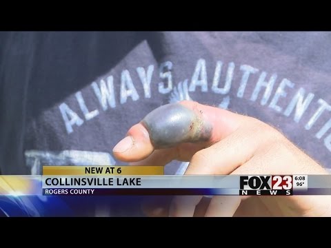Man bitten by water moccasin at Collinsville Lake | FOX23 News Tulsa