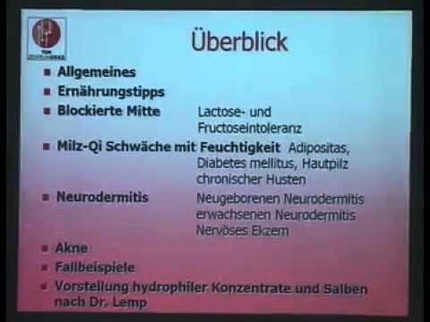 Ultraschall-Prostata Mytishchi Ihtiolovye Kerzen Dosierung für Prostatitis